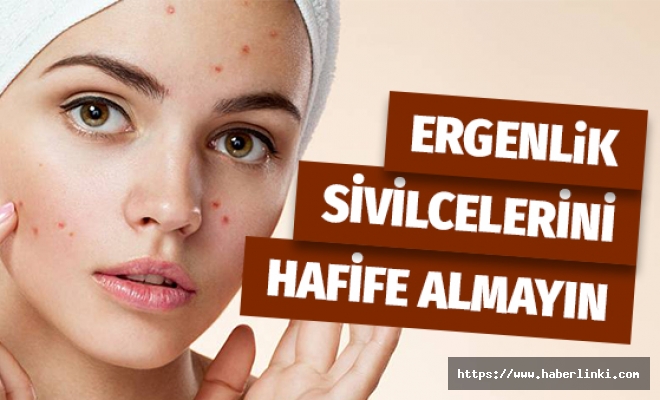 Ergenlik Sivilcelerini Hafife Almayın