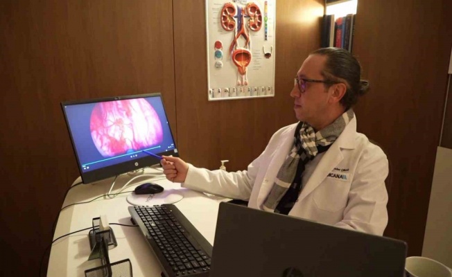 Prostata ’holep’ ile kesin çözüm: 400 grama kadar prostat güvenle alınabiliyor